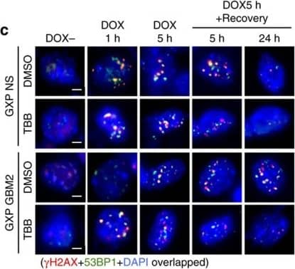 Immunocytochemistry/ Immunofluorescence 53BP1 Antibody - BSA Free