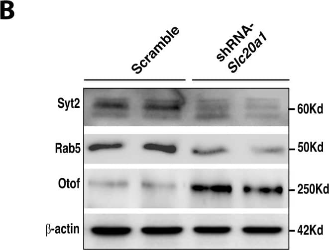 Western Blot Synaptotagmin 2 Antibody