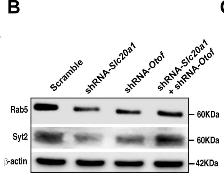 Western Blot Synaptotagmin 2 Antibody