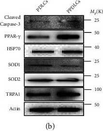 Western Blot: TRPA1 Antibody [NB100-91319] - Periodontitis-derived periodontal ligament cells & tissues were at high levels of oxidative stress & apoptosis. (a) The related gene expressions of oxidative stress, apoptosis, & some of the TRP families in healthy & periodontitis-derived periodontal ligament cells (PDLCs & P-PDLCs) (n = 3). (b, c) Western blot & semiquantitative statistical analysis of oxidative stress, apoptosis, & TRPA1 in PDLCs & P-PDLCs. (n = 3). d, Flow cytometry analysis of PDLCs & P-PDLCs (n = 4). (e, f) H&E staining (white star represent immune cell infiltration), immunohistochemistry & immunofluorescence staining, & semiquantitative statistical analysis of periodontitis & healthy derived periodontal ligament tissues (PDLTs & P-PDLTs) (n = 3). Data analysis was performed by using Student's t-test (∗P < 0.05, ∗∗P < 0.01, & ∗∗∗P < 0.001). The data are presented as the mean ± SEM. Image collected & cropped by CiteAb from the following publication (//pubmed.ncbi.nlm.nih.gov/35720191), licensed under a CC-BY license. Not internally tested by Novus Biologicals.