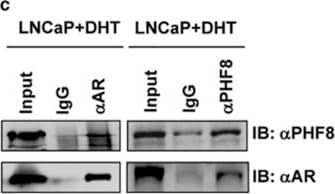 Western Blot: PHF8 Antibody [NB100-93314] - PHF8 interacts with the AR & functions as an AR coactivator. (a) PHF8 interacts with AR independent of DHT. HEK293T cells were transiently transfected with plasmids expressing Flag-tagged PHF8 & GFP-tagged AR. Cells were treated with or without 10 nM DHT for 48 h & the cell lysates were used for immunoprecipitation with antibodies against either Flag or GFP. Western blotting was conducted with antibodies as indicated. (b) PHF8 interacts with AR independent of its demethylase activity. HEK293T cells were transiently transfected with plasmids expressing Flag-tagged PHF8 (H247A) mutant & GFP-tagged AR. The interaction assay by co-immunoprecipitation was performed as described above. (c) In LNCaP cells endogenous PHF8 interacts with AR. LNCaP cells were treated with 10 nM DHT for 48 h & the cell lysates were used for immunoprecipitation with antibodies against either PHF8 or AR. Western blotting was conducted with AR or PHF8 antibody as indicated. (d) PHF8 enhances AR transcriptional activation in a demethylase activity-dependent manner. HeLa cells were co-transfected with the 4 × UAS-TK-luc reporter, the plasmids expressing the fusion protein Gal-AR, & increased amount of either the wild-type PHF8 or mutant PHF8 (H247A) as indicated. Cells were cultured with or without 10 nM R1881 overnight. The relative luciferase activities in the cell lysates were normalized to renilla luciferase activity. The relative luciferase activities are presented as mean±s.e.m. of three independent transfections & the levels of PHF8 were estimated by western blot as depicted in the bottom panel. Image collected & cropped by CiteAb from the following publication (//www.nature.com/articles/oncsis201674), licensed under a CC-BY license. Not internally tested by Novus Biologicals.