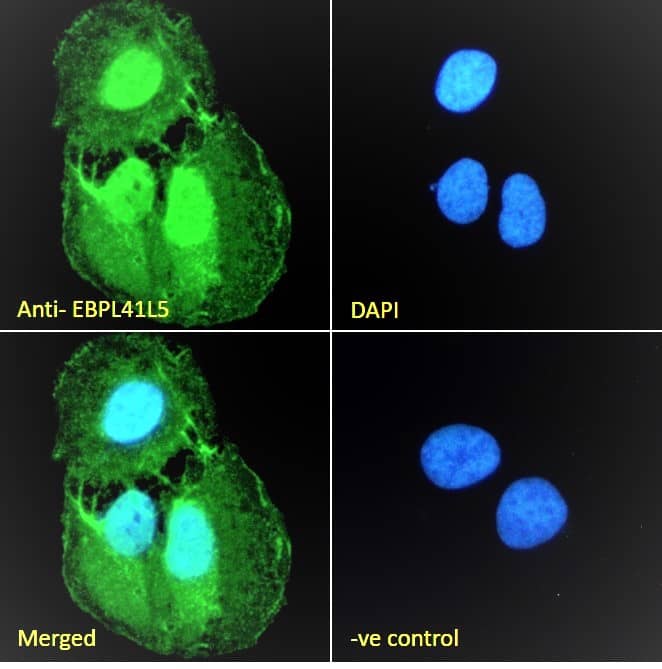 Immunocytochemistry/Immunofluorescence: EPB41L5 Antibody [NB100-93392] - Immunofluorescence analysis of paraformaldehyde fixed U2OS cells, permeabilized with 0.15% Triton. Primary incubation 1hr (10ug/ml) followed by Alexa Fluor 488 secondary antibody (2ug/ml), showing nuclear, plasma membrane and cytoplasmic staining. The nuclear stain is DAPI (blue). Negative control: Unimmunized goat IgG (10ug/ml) followed by Alexa Fluor 488 secondary antibody (2ug/ml).