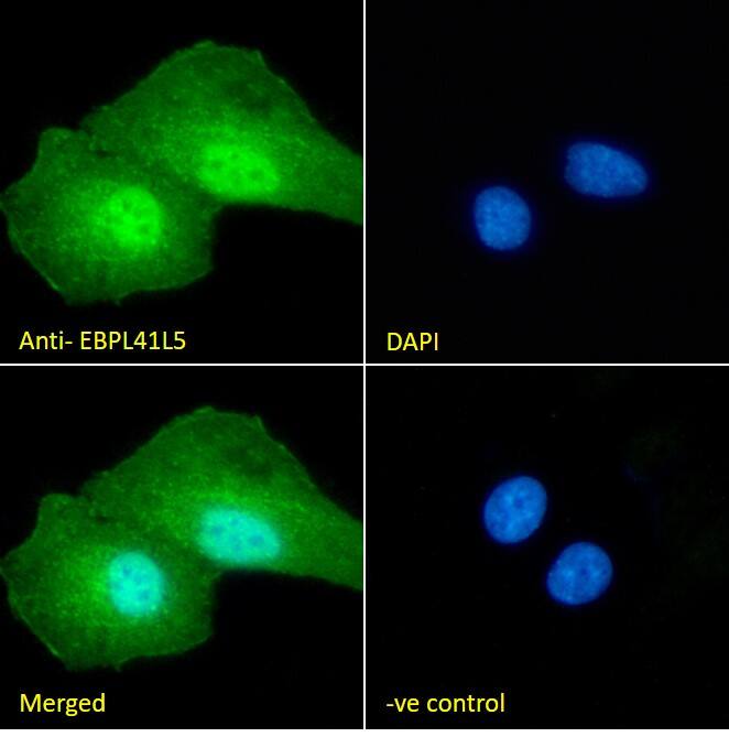 Immunocytochemistry/Immunofluorescence: EPB41L5 Antibody [NB100-93392] - Immunofluorescence analysis of paraformaldehyde fixed A549 cells, permeabilized with 0.15% Triton. Primary incubation 1hr (10ug/ml) followed by Alexa Fluor 488 secondary antibody (2ug/ml), showing nuclear and cytoplasmic staining. The nuclear stain is DAPI (blue). Negative control: Unimmunized goat IgG (10ug/ml) followed by Alexa Fluor 488 secondary antibody (2ug/ml).