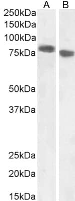 Western Blot: EPB41L5 Antibody [NB100-93392] - (1ug/ml) staining of A431 (A) and (0.3ug/ml) MCF7 (B) cell lysate (35ug protein in RIPA buffer). Detected by chemiluminescence.