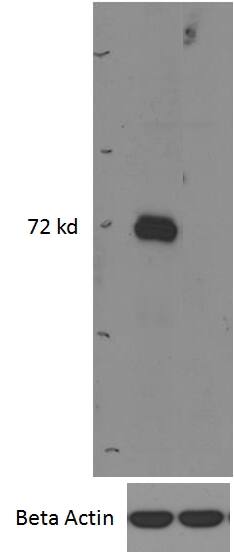 <b>Genetic Strategies Validation. </b>Western Blot: IRAK3 Antibody [NB100-96912] - (0.5ug/ml) staining of Mouse Bone Marrow (wildtype first lane, KO second lane) lysates (35ug protein in RIPA buffer). Primary incubation was overnight at 4C Detected with chemiluminescence. Data obtained from anonymous customer.