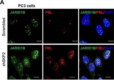 SKP2 inactivation induces an accumulation of ubiquitinated JARID1B in nucleolus of cells in vitro and in vivo for cellular senescence(A) Immunofluorescence (IF) images show a co-localization of endogenous JARID1B and Fibrillarin (FBL) in nucleoli of PC3 cells upon SKP2 knockdown (Also see Supplementary Figure S6A). FBL indicates a nucleolar marker. Right panel: quantification of PC3 cells showing an increase of JARID1B localization in nucleolus. Error bars represent means +/- SD. (B) IF images show a co-localization of endogenous JARID1B and K63-Ub in nucleoli of PC3 cells upon SKP2 knockdown. (C) Western blotting assay shows an increase of  beta -galactosidase ( beta -Gal) in PC3 cells upon SKP2 knockdown. (D) IF images show JARID1B in nucleolus as indicated by arrows and  beta -Gal in cytoplasm in senescent cells upon SKP2 knockdown. (E) The co-localization of endogenous JARID1B and Fibrillarin (FBL) in nucleoli of prostate tissues in Ptenpc−/−;Trp53pc−/−;Skp2−/− mutant mice (Also see Supplementary Figure S6B). Scale bars represent 10 μm for panel A, B, D and E. (F) The positive staining of  beta -galactosidase in prostate tissues of Ptenpc−/−;Trp53pc−/−;Skp2−/− mice but not in that of Ptenpc−/−;Trp53pc−/− mice. Scale bars represent 50 μm. Image collected and cropped by CiteAb from the following open publication (//pubmed.ncbi.nlm.nih.gov/25596733), licensed under a CC-BY license. Not internally tested by Novus Biologicals.