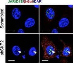 SKP2 inactivation induces an accumulation of ubiquitinated JARID1B in nucleolus of cells in vitro and in vivo for cellular senescence(A) Immunofluorescence (IF) images show a co-localization of endogenous JARID1B and Fibrillarin (FBL) in nucleoli of PC3 cells upon SKP2 knockdown (Also see Supplementary Figure S6A). FBL indicates a nucleolar marker. Right panel: quantification of PC3 cells showing an increase of JARID1B localization in nucleolus. Error bars represent means +/- SD. (B) IF images show a co-localization of endogenous JARID1B and K63-Ub in nucleoli of PC3 cells upon SKP2 knockdown. (C) Western blotting assay shows an increase of  beta -galactosidase ( beta -Gal) in PC3 cells upon SKP2 knockdown. (D) IF images show JARID1B in nucleolus as indicated by arrows and  beta -Gal in cytoplasm in senescent cells upon SKP2 knockdown. (E) The co-localization of endogenous JARID1B and Fibrillarin (FBL) in nucleoli of prostate tissues in Ptenpc−/−;Trp53pc−/−;Skp2−/− mutant mice (Also see Supplementary Figure S6B). Scale bars represent 10 μm for panel A, B, D and E. (F) The positive staining of  beta -galactosidase in prostate tissues of Ptenpc−/−;Trp53pc−/−;Skp2−/− mice but not in that of Ptenpc−/−;Trp53pc−/− mice. Scale bars represent 50 μm. Image collected and cropped by CiteAb from the following open publication (//pubmed.ncbi.nlm.nih.gov/25596733), licensed under a CC-BY license. Not internally tested by Novus Biologicals.