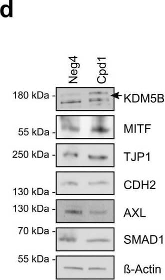 Enforced KDM5B expression facilitates melanocytic lineage-directed elimination by TMECG.a Quantitation of mRNA after 24 h, 48 h, 72 h and 7 days of Cpd1 treatment of MaMel63a cells as assessed by qPCR. Mean +/- SD. Shown is one representative example. b Regulation of differentiation, cytokinesis, and mitotic spindle assembly genes as detected by cDNA microarray analysis after KDM5B shRNA knockdown in WM3734 cells (n = 1). c, d Immunoblotting of melanocytic lineage and (de-)differentiation markers after 24 h of KDM5B induction in WM3734Tet3G-KDM5B cells (c) and after 72 h of Cpd1 treatment in MaMel63a cells (d). Shown are representative data (n = 2). e Anti-MITF immunostaining (upper panel) and Fontana-Masson staining (lower panels) of CM melanoma tumor grafts from Cpd1-treated vs. control mice. f MTT cell viability assay of WM3734 cells. Representative example is shown left (mean +/- SD, n = 2) and corresponding IC50 values on the right. TMECG was either concurrently given together with Cpd1 (“con