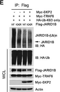 SKP2 regulates the ubiquitination of JARID1B through TRAF6(A) Immunofluorescence images show a co-localization of endogenous JARID1B and TRAF6 in PC3 cells. Scale bars represent 10 μm. (B) and (C) Co-immunoprecipitation analysis shows that endogenous TRAF6 physically interacts with JARID1B in PC3 cells, as shown by reciprocal co-immunoprecipitation between the two proteins (Also see Supplementary Figure S5). (D)In vivo ubiquitination assay shows that TRAF6 increases K63-linked ubiquitination of JARID1B and SKP2 inhibits TRAF6-mediated JARID1B ubiquitination. Cells were transfected with Flag-JARID1B, HA-Ub-K63-only, Myc-TRAF6 and Myc-SKP2 constructs as indicated. WCL indicates the whole cell lysates. (E) TRAF6 mediates JARID1B ubiquitination through lysine residue 242. HEK293T cells were transfected with Flag-JARID1B WT or Flag-JARID1B-K242R, HA-Ub-K63-only, Myc-TRAF6 and Myc-SKP2 plasmids as indicated. In vivo ubiquitination assay was performed in a standard procedure. WCL indicates the whole cell lysates. Image collected and cropped by CiteAb from the following open publication (//pubmed.ncbi.nlm.nih.gov/25596733), licensed under a CC-BY license. Not internally tested by Novus Biologicals.