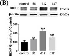 Western Blot: BDNF Antibody [NB100-98682] - The expression of BDNF-TrkB signaling in the SDH of CYP-induced cystitis. a Changes of the mechanical threshold in CYP-induced cystitis model. Compared to that in the control group, the mechanical threshold of the cystitis group decreased significantly after the CYP injection & remained low until day 17, & the minimum threshold value was reached on day 12. The expression of b BDNF, c TrkB, & dp-TrkB were evaluated by western blots. Compared to the control group, they were upregulated on days 8, 12, & 17. e Immunofluorescence double staining assay of BDNF & p-TrkB in the SDH. BDNF & p-TrkB (red), NeuN, GFAP, & OX-42( green), co-localization (yellow). BDNF was mainly colocalized in neurons which mainly located in Laminate II to IV. & TrkB receptors expressed in neurons, microglia, & astrocytes. The white dotted lines in picture “BDNF/NeuN” showed the laminate of the SDH according to Rexed & Steiner. Scale bar = 100 μm. All data were calculated as mean ± SEM (n = 5 per group). *p < 0.05, ** p < 0.01, *** p < 0.001 vs. the control group Image collected & cropped by CiteAb from the following publication (//pubmed.ncbi.nlm.nih.gov/31931832), licensed under a CC-BY license. Not internally tested by Novus Biologicals.