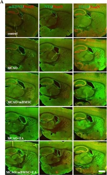 Immunohistochemistry: BDNF Antibody [NB100-98682] - Effects of mBMSC & EA treatment on the expression of trophic factors. (A) Photomicrographs & (B‒D) histograms for mBDNF, NT4, & VEGF expression (n = 4–5). mBDNF expression was markedly increased by treatment with mBMSC and/or EA compared to vehicle treatment. mBDNF expression levels were higher in the EA-treated MCAO group than in the mBMSC-treated MCAO group. NT4 expression in the SVZ & hippocampus was significantly higher in the combined mBMSC & EA treatment group than in the other groups. VEGF expression in the hippocampus was markedly higher in the mBMSC treatment group than in the vehicle-treated MCAO group. #p < 0.05, ##p < 0.01, & ###p < 0.001 versus control group; *p < 0.05, **p < 0.01, & ***p < 0.001 versus vehicle-treated MCAO group; &p < 0.05, &&p < 0.01, & &&&p < 0.001 versus mBMSC-treated MCAO group; Scale bar = 1 mm. Image collected & cropped by CiteAb from the following publication (//pubmed.ncbi.nlm.nih.gov/29391466), licensed under a CC-BY license. Not internally tested by Novus Biologicals.