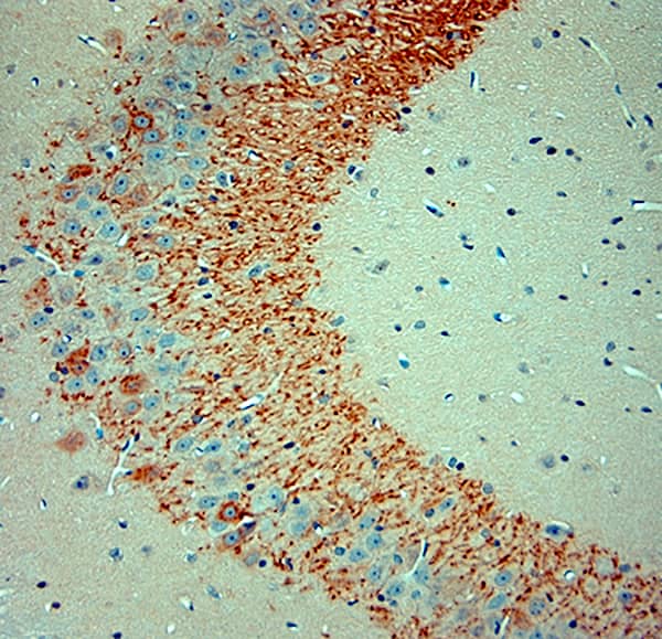 Immunohistochemistry (IHC-P) on paraffin-embedded rat hippocampus sections detecting proBDNF using NB100-98756. The animal was perfused at a pressure of 130 mmHg with 300 mL of 4% formaldehyde, followed by overnight post-fixation prior to paraffin processing and embedding. Heat-induced epitope retrieval (HIER) was performed in Tris-EDTA buffer (pH 9.0) for 20 minutes. Sections were blocked with 0.2% low-fat dry milk (LFDM) in PBST. The primary antibody was applied at a dilution of 1:1000 and incubated for 30 minutes at room temperature. Detection was performed using a HRP Polymer Detection System, followed by visualization with DAB Chromogen. Sections were counterstained with Harris hematoxylin.