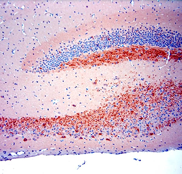 Immunohistochemistry (IHC-P) on paraffin-embedded rat hippocampus sections detecting proBDNF using NB100-98756. The animal was perfused at a pressure of 130 mmHg with 300 mL of 4% formaldehyde, followed by overnight post-fixation prior to paraffin processing and embedding. Heat-induced epitope retrieval (HIER) was performed in Tris-EDTA buffer (pH 9.0) for 20 minutes. Sections were blocked with 0.2% low-fat dry milk (LFDM) in PBST. The primary antibody was applied at a dilution of 1:1000 and incubated for 30 minutes at room temperature. Detection was performed using a HRP Polymer Detection System, followed by visualization with DAB Chromogen. Sections were counterstained with Harris hematoxylin.