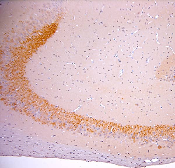 Immunohistochemistry (IHC-P) on paraffin-embedded rat hippocampus sections detecting proBDNF using NB100-98756. The animal was perfused using Osenses Autoperfuser at a pressure of 130 mmHg with 300 mL of 4% formaldehyde, followed by overnight post-fixation prior to paraffin processing and embedding. Heat-induced epitope retrieval (HIER) was performed in Tris-EDTA buffer (pH 9.0) for 20 minutes. Sections were blocked with 0.2% low-fat dry milk (LFDM) in PBST. The primary antibody was applied at a dilution of 1:1000 and incubated for 30 minutes at room temperature. Detection was performed using a HRP Polymer Detection System, followed by visualization with DAB Chromogen. Sections were counterstained with Harris hematoxylin.