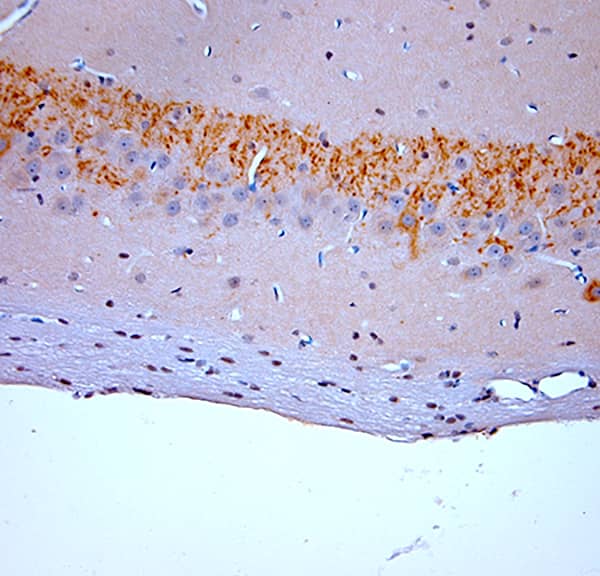 Immunohistochemistry (IHC-P) on paraffin-embedded rat hippocampus sections detecting proBDNF using NB100-98756. The animal was perfused using at a pressure of 130 mmHg with 300 mL of 4% formaldehyde, followed by overnight post-fixation prior to paraffin processing and embedding. Heat-induced epitope retrieval (HIER) was performed in Tris-EDTA buffer (pH 9.0) for 20 minutes. Sections were blocked with 0.2% low-fat dry milk (LFDM) in PBST. The primary antibody was applied at a dilution of 1:1000 and incubated for 30 minutes at room temperature using the Osenses HistoLogic™ Stainer. Detection was performed using a HRP Polymer Detection System, followed by visualization with DAB Chromogen. Sections were counterstained with Harris hematoxylin.