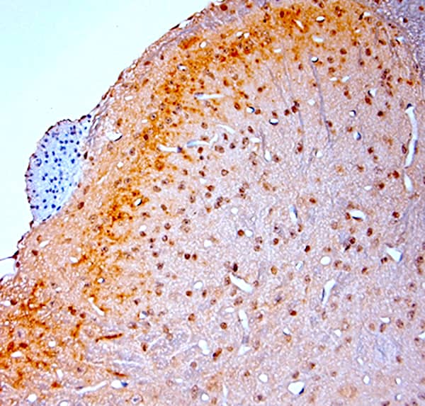 Immunohistochemistry (IHC-P) on paraffin-embedded rat spinal cord sections detecting proBDNF using NB100-98756. The animal was perfused using Osenses Autoperfuser at a pressure of 130 mmHg with 300 mL of 4% formaldehyde, followed by overnight post-fixation prior to paraffin processing and embedding. Heat-induced epitope retrieval (HIER) was performed in Tris-EDTA buffer (pH 9.0) for 20 minutes. Sections were blocked with 0.2% low-fat dry milk (LFDM) in PBST. The primary antibody was applied at a dilution of 1:1000 and incubated for 30 minutes at room temperature. Detection was performed using a HRP Polymer Detection System, followed by visualization with DAB Chromogen. Sections were counterstained with Harris hematoxylin.