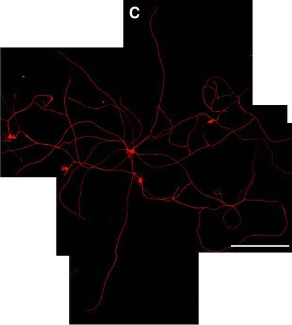 Immunocytochemistry/ Immunofluorescence: Alkaline Phosphatase/ALPP Antibody (8B6) - BSA Free [NB110-3638] - GRPs enhance axonal growth in DRGs in vitro. A–C, Representative montage images are shown for control dissociated DRG culture (A), dissociated DRGs cocultured with rat GRPs (B), & dissociated DRGs cultures exposed to conditioned medium from alkaline phosphatase-expressing rat GRPs (C).  beta III-tubulin (red) immunofluorescence highlights the neurons; GRPs are visualized by immunostaining for alkaline phosphatase (green). D shows quantification for the average length of the longest axon per neuron ± SEM (n ≥ 30 neurons in three separate experiments; **p ≤ 0.01 by Student’s t test). Scale bar, 250 μm. Image collected & cropped by CiteAb from the following publication (//www.eneuro.org/lookup/doi/10.1523/ENEURO.0171-16.2017), licensed under a CC-BY license. Not internally tested by Novus Biologicals.