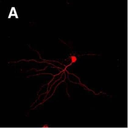 Immunocytochemistry/ Immunofluorescence: Alkaline Phosphatase/ALPP Antibody (8B6) - BSA Free [NB110-3638] - GRPs enhance axonal growth in DRGs in vitro. A–C, Representative montage images are shown for control dissociated DRG culture (A), dissociated DRGs cocultured with rat GRPs (B), & dissociated DRGs cultures exposed to conditioned medium from alkaline phosphatase-expressing rat GRPs (C).  beta III-tubulin (red) immunofluorescence highlights the neurons; GRPs are visualized by immunostaining for alkaline phosphatase (green). D shows quantification for the average length of the longest axon per neuron ± SEM (n ≥ 30 neurons in three separate experiments; **p ≤ 0.01 by Student’s t test). Scale bar, 250 μm. Image collected & cropped by CiteAb from the following publication (//www.eneuro.org/lookup/doi/10.1523/ENEURO.0171-16.2017), licensed under a CC-BY license. Not internally tested by Novus Biologicals.