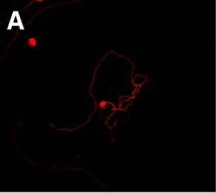 Immunocytochemistry/ Immunofluorescence: Alkaline Phosphatase/ALPP Antibody (8B6) - BSA Free [NB110-3638] - Coculture with neural & glial progenitor cells increases axonal outgrowth from adult DRG neurons. A–C, Representative montage images of control-dissociated DRG cultures (A), dissociated DRGs cocultured with rat GRPs/NRPs (B), & dissociated DRG cultures exposed to conditioned medium from parallel rat GRP/NRP cultures (C) are shown. Immunofluorescence for  beta III-tubulin (red) & nestin (green) highlight DRG neurons & GRP/NRP nuclei, respectively. D, Quantitation of the average lengths of the longest axon per neuron (±SEM) for the above conditions is shown. Coculture with GRPs/NRPs significantly increases in axon length compared with the standard DRG culture; exposure to conditioned medium from GRP/NRP cultures showed a further increase in axon length (n ≥ 30 neurons in three separate experiments; *p ≤ 0.05 & ***p ≤ 0.001 by Student’s t test). Scale bar, 250 μm. E, Quantitation of axon growth parameters for 7 d injury-conditioned DRG neurons cultured on coverslips laid over a bed of GRP/NRP cells (coculture) or control conditions is shown (n ≥ 200 neurons analyzed in three separate experiments; p values represent ANOVA with Tukey post hoc analyses). Image collected & cropped by CiteAb from the following publication (//www.eneuro.org/lookup/doi/10.1523/ENEURO.0171-16.2017), licensed under a CC-BY license. Not internally tested by Novus Biologicals.