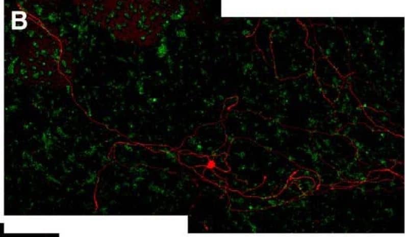 Immunocytochemistry/ Immunofluorescence: Alkaline Phosphatase/ALPP Antibody (8B6) - BSA Free [NB110-3638] - Coculture with neural & glial progenitor cells increases axonal outgrowth from adult DRG neurons. A–C, Representative montage images of control-dissociated DRG cultures (A), dissociated DRGs cocultured with rat GRPs/NRPs (B), & dissociated DRG cultures exposed to conditioned medium from parallel rat GRP/NRP cultures (C) are shown. Immunofluorescence for  beta III-tubulin (red) & nestin (green) highlight DRG neurons & GRP/NRP nuclei, respectively. D, Quantitation of the average lengths of the longest axon per neuron (±SEM) for the above conditions is shown. Coculture with GRPs/NRPs significantly increases in axon length compared with the standard DRG culture; exposure to conditioned medium from GRP/NRP cultures showed a further increase in axon length (n ≥ 30 neurons in three separate experiments; *p ≤ 0.05 & ***p ≤ 0.001 by Student’s t test). Scale bar, 250 μm. E, Quantitation of axon growth parameters for 7 d injury-conditioned DRG neurons cultured on coverslips laid over a bed of GRP/NRP cells (coculture) or control conditions is shown (n ≥ 200 neurons analyzed in three separate experiments; p values represent ANOVA with Tukey post hoc analyses). Image collected & cropped by CiteAb from the following publication (//www.eneuro.org/lookup/doi/10.1523/ENEURO.0171-16.2017), licensed under a CC-BY license. Not internally tested by Novus Biologicals.