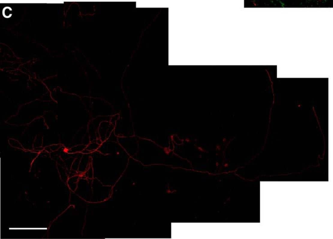 Immunocytochemistry/ Immunofluorescence: Alkaline Phosphatase/ALPP Antibody (8B6) - BSA Free [NB110-3638] - Coculture with neural & glial progenitor cells increases axonal outgrowth from adult DRG neurons. A–C, Representative montage images of control-dissociated DRG cultures (A), dissociated DRGs cocultured with rat GRPs/NRPs (B), & dissociated DRG cultures exposed to conditioned medium from parallel rat GRP/NRP cultures (C) are shown. Immunofluorescence for  beta III-tubulin (red) & nestin (green) highlight DRG neurons & GRP/NRP nuclei, respectively. D, Quantitation of the average lengths of the longest axon per neuron (±SEM) for the above conditions is shown. Coculture with GRPs/NRPs significantly increases in axon length compared with the standard DRG culture; exposure to conditioned medium from GRP/NRP cultures showed a further increase in axon length (n ≥ 30 neurons in three separate experiments; *p ≤ 0.05 & ***p ≤ 0.001 by Student’s t test). Scale bar, 250 μm. E, Quantitation of axon growth parameters for 7 d injury-conditioned DRG neurons cultured on coverslips laid over a bed of GRP/NRP cells (coculture) or control conditions is shown (n ≥ 200 neurons analyzed in three separate experiments; p values represent ANOVA with Tukey post hoc analyses). Image collected & cropped by CiteAb from the following publication (//www.eneuro.org/lookup/doi/10.1523/ENEURO.0171-16.2017), licensed under a CC-BY license. Not internally tested by Novus Biologicals.