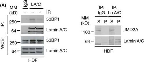 Lamin A/C-53BP1 interaction is regulated in a DNA damage-dependent manner. (A) Left; HDF were subjected to IR (10 Gy) & allowed to recover for 1 h. Association between A-type lamins & 53BP1 was assessed by immunoprecipitation of endogenous lamin A/C followed by immunoblotting with 53BP1 & lamin A/C antibodies. WCE, whole cell extract, IP: immunoprecipitates. WCE represents 5% input. Right; endogenous lamin A/C was immunoprecipitated & supernatants or pellets were analysed by immunoblotting for interaction with JMJD2A. (B) U2OS/GFP-lamin A cells were pretreated with caffeine (20 mm) for 1 h before exposure to IR (10 Gy, 1 h recovery). Cell extracts were then subjected to immunoprecipitation using GFP-Trap beads, & bound complexes were then analysed by immunoblotting using 53BP1 & GFP antibodies. WCE represents 1% input. (C) As in (C) except cells were pretreated with 10 μm ATMi for 1 h before IR. WCE represents 1% input. (D) U2OS/GFP-lamin A cells were subjected to laser micro-irradiation, fixed 1 h later & immunostained with  gamma -H2AX antibody. Scale bar, 10 μm. (E) U2OS cells were transfected with siCTRL or siLMNA & subjected to laser micro-irradiation, fixed 15 min later & then processed for immunofluorescence with  gamma -H2AX & 53BP1 antibodies. Scale bar, 10 μm. Image collected & cropped by CiteAb from the following publication (//pubmed.ncbi.nlm.nih.gov/25645366), licensed under a CC-BY license. Not internally tested by Novus Biologicals.