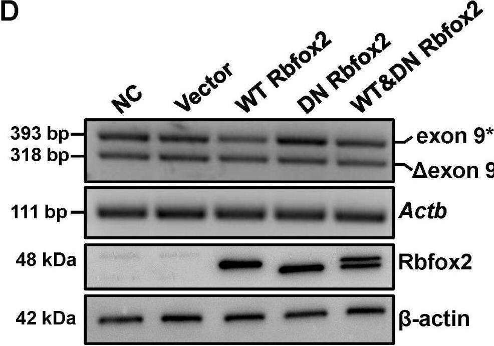 Rbfox2 specifically modulates CaV1.2 alternative exon 9* splicing in cardiomyocyte. (A) H9c2 cells were transfected with nontargeting (NT) or Rbfox2 siRNA for 48 h. The endogenous expression of Rbfox2 protein was detected by Western blotting, the  beta -actin was detected as internal control. PCR product of CaV1.2E9* channel was amplified from cDNA libraries and separated on 2.5% agarose gel. Actb mRNA was detected as internal control. (B) The relative expression of Rbfox2 was normalized to  beta -actin. (C) The value for percent CaV1.2E9* inclusion was the upper band intensity divided by the summed intensities of upper and lower bands, and presented as a bar chart. (D) H9c2 cells were transfected with an empty vector, WT Rbfox2, DN Rbfox2 or WT plus DN Rbfox2 expression plasmids, nontreated cells were set as negative control (NC). After 48 h incubation, the expression of Rbfox2 protein was detected by Western blotting, the  beta -actin was detected as internal control. PCR products were separated on 2–3% agarose gel, which was used to check the proportions of CaV1.2E9* channels. (E) Relative expression of Rbfox2 was normalized to  beta -actin. (F) The proportion of CaV1.2E9* channels were analyzed and presented by a bar chart. n = 3 independent experiments. *P < 0.05, **P < 0.01, one-way ANOVA followed by a Tukey’s post hoc test Image collected and cropped by CiteAb from the following open publication (//pubmed.ncbi.nlm.nih.gov/37415128), licensed under a CC-BY license. Not internally tested by Novus Biologicals.