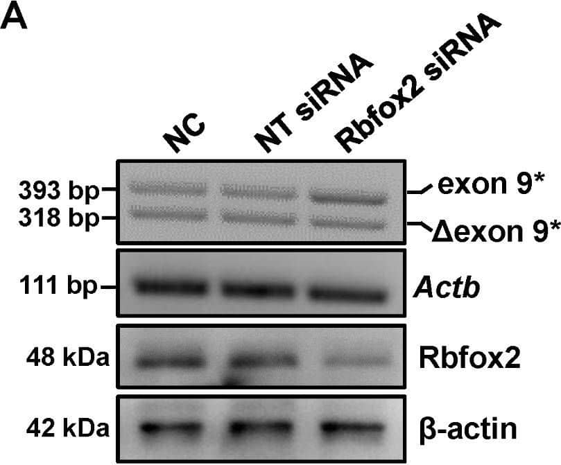Rbfox2 specifically modulates CaV1.2 alternative exon 9* splicing in cardiomyocyte. (A) H9c2 cells were transfected with nontargeting (NT) or Rbfox2 siRNA for 48 h. The endogenous expression of Rbfox2 protein was detected by Western blotting, the  beta -actin was detected as internal control. PCR product of CaV1.2E9* channel was amplified from cDNA libraries and separated on 2.5% agarose gel. Actb mRNA was detected as internal control. (B) The relative expression of Rbfox2 was normalized to  beta -actin. (C) The value for percent CaV1.2E9* inclusion was the upper band intensity divided by the summed intensities of upper and lower bands, and presented as a bar chart. (D) H9c2 cells were transfected with an empty vector, WT Rbfox2, DN Rbfox2 or WT plus DN Rbfox2 expression plasmids, nontreated cells were set as negative control (NC). After 48 h incubation, the expression of Rbfox2 protein was detected by Western blotting, the  beta -actin was detected as internal control. PCR products were separated on 2–3% agarose gel, which was used to check the proportions of CaV1.2E9* channels. (E) Relative expression of Rbfox2 was normalized to  beta -actin. (F) The proportion of CaV1.2E9* channels were analyzed and presented by a bar chart. n = 3 independent experiments. *P < 0.05, **P < 0.01, one-way ANOVA followed by a Tukey’s post hoc test Image collected and cropped by CiteAb from the following open publication (//pubmed.ncbi.nlm.nih.gov/37415128), licensed under a CC-BY license. Not internally tested by Novus Biologicals.