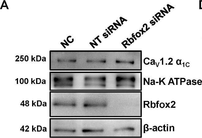 Knockdown of Rbfox2 hyperpolarizes window currents of CaV1.2 channel in NRVMs. (A) The protein expression of Rbfox2 and  beta -actin were detected in whole-cell lysate of isolated NRVMs by using Western blotting after transfecting with NT or Rbfox2 siRNAs. The membrane protein was also extracted, and membrane expression of CaV1.2  alpha 1C was checked, Na-K ATPase was detected as a membrane loading control. (B) Relative expression level of Rbfox2 was normalized with  beta -actin in differentially transfected cells, and presented as a bar chart. n = 4 independent experiments. **P < 0.001, one-way ANOVA followed by a Tukey’s post hoc test. (C) Relative CaV1.2  alpha 1C membrane expression was normalized with Na-K ATPase in differentially-transfected cells. n = 4 independent experiments. P = 0.6679, one-way ANOVA followed by a Tukey’s post hoc test. (D) Raw traces of CaV1.2 whole-cell calcium current recorded from NRVMs treated with NT or Rbfox2 siRNA in 10 mmol/L Ba2+ external solution. (E) I-V relationship of calcium channel current recorded under the different testing potential, increased from − 50 to 50 mV in NRVMs transfected with NT or Rbfox2 siRNA. (F) CaV1.2 channel current density in NRVMs was analyzed after transfected with NT or Rbfox2 siRNA. (H) Plots of steady-state activation (SSA) curve of CaV1.2 channel were analyzed from I-V currents in NT or Rbfox2 siRNA-treated NRVMs. (H) Plots of the steady-state inactivation (SSI) was also recorded in NRVMs. (I) CaV1.2 window currents were superimposed from SSI (f∞) and SSA (d∞) curves of NRVMs Image collected and cropped by CiteAb from the following open publication (//pubmed.ncbi.nlm.nih.gov/37415128), licensed under a CC-BY license. Not internally tested by Novus Biologicals.