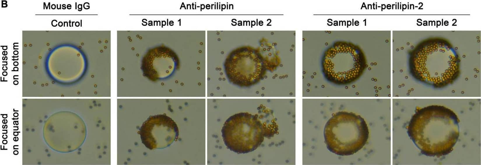 Basic CFO structure. Basic CFO structure was investigated by determining the presence of an enveloping surface membrane and absence of a cell nucleus-like structure. (A) Some CFOs displayed a wrinkled surface (Control, CFO only) suggesting the presence of an enveloping membrane. The enveloping surface membrane and absence of a nucleus-like structure were investigated with positive staining by membrane-specific CellMask green and negative staining of DNA-binding Hoechst 33,342, respectively. K562 cells were added to indicate positive staining (200×). CellTrace CFSE failed completely to stain CFOs. (B) An indirect detection method for CFO membrane was tested by detecting membrane perilipin and perilipin-2 proteins with biotin-conjugated specific antibodies, which were revealed by secondary binding of streptavidin-conjugated nanoparticles, each of which was 4.5 μm in diameter. During microscopic imaging (400×), when the focus was set on bottom of a CFO, nanoparticles binding specifically on the CFO could be seen. Image collected and cropped by CiteAb from the following open publication (//pubmed.ncbi.nlm.nih.gov/35237181), licensed under a CC-BY license. Not internally tested by Novus Biologicals.