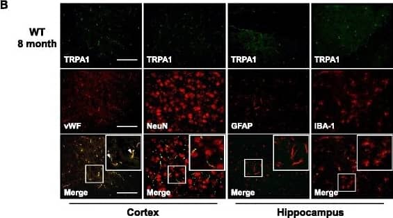 Immunocytochemistry/ Immunofluorescence: TRPA1 Antibody - BSA Free [NB110-40763] - Expression & localization of TRPA1 channels in wild-type (WT) & APP/PS1 Tg mice. (a) Brains were harvested from WT & APP/PS1 Tg mice at 8 months old. Western blot analysis of protein levels of TRPA1 &  alpha -tubulin. Data are mean ± SEM from 6 mice in each group. *, P < 0.05 vs. WT mice. (b, c) Immunohistochemistry of specimens of cortex & hippocampus from 8-month-old WT & APP/PS1 Tg mice with the antibodies anti-TRPA1, anti-vWF (endothelial cell marker), anti-NeuN (neuron marker), anti-GFAP (astrocyte marker) & anti-IBA-1 (microglia marker), then FITC- or Texas red-conjugated secondary antibody. Bar = 50 μm. vWF-positive cells denoted endothelial cells, NeuN-positive cells denoted neurons, & GFAP-positive cells denoted astrocytes, as indicated by arrowheads, stars or arrows, respectively Image collected & cropped by CiteAb from the following publication (//jneuroinflammation.biomedcentral.com/articles/10.1186/s12974-016-0557-z), licensed under a CC-BY license. Not internally tested by Novus Biologicals.