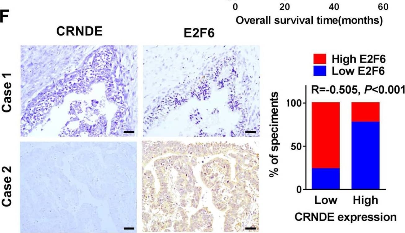  The E2F6-CRNDE axis is clinically related to chemoresistant GC and poor outcome in advanced GC patients. (A) The expression of CRNDE and E2F6 were detected by qPCR assay in GC cell lines. (B) The correlation of CRNDE and E2F6 was analyzed in GC cell lines. (C) The subcellular localization and intensity of CRNDE were examined with in situ hybridization (ISH) in sections from GC patients. Scale bar: 50 um. (D) Retrospective analysis of Kaplan-Meier plots for CRNDE expression and the association with disease-free survival (DSF) and overall survival (OS) in GC patients. (E) Retrospective analysis of Kaplan-Meier plots for CRNDE expression and the association with disease-free survival (DSF) and overall survival (OS) in GC patients treated with oxaliplatin and 5-FU-based chemotherapy after surgery. (F) Representative ISH and IHC staining of GC tissues indicated a negative correlation between CRNDE and E2F6. Bars blow indicates the percentage of patients. Spearman's correlation analysis (G) Kaplan-Meier analysis of GC overall survival (OS) corresponding to the expression of E2F6 analysed by the online Kaplan Meier Plotter database (//kmplot.com/analysis/). *P < 0.05, **P < 0.01, ***P < 0.001. Image collected and cropped by CiteAb from the following open publication (//pubmed.ncbi.nlm.nih.gov/36046639), licensed under a CC-BY license. Not internally tested by Novus Biologicals.
