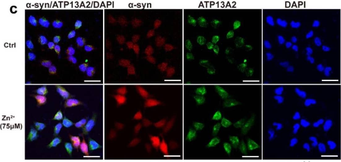 Immunocytochemistry/ Immunofluorescence ATP13A2 Antibody - BSA Free