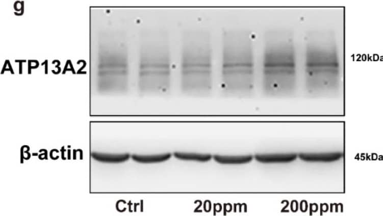 Western Blot ATP13A2 Antibody - BSA Free