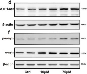 Western Blot ATP13A2 Antibody - BSA Free