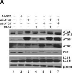 ATG5 & ATG7 enhanced autophagy & inhibited ER stress in chondrocyte. a Western blotting analysis of LC3, P62, ATG5, ATG7 & ATG5-ATG12 expression after infected with Ad-ATG5, Ad-ATG7 & Ad-ATG5 + Ad-ATG7 in the C28I2 cells.  beta -actin is served as an internal control. b Qualitative analysis of ATG5, ATG7, ATG5-ATG12, LC3 & P62. The values were normalized to  beta -actin. c C28I2 cells were double stained with LC3 (red) & DAPI (blue) & visualized by confocal microscopy (400X) after treated with Rapamycine, Ad-ATG5, Ad-ATG7 & Ad-ATG5 + Ad-ATG7 24 h. *P < 0.05, **P < 0.01 compared with the controls. Values are means ± SD n = 3). d Qualitative analysis of LC3 fluorescence intensity of chondrocytes. The values were normalized to the NC group. e Western blotting analysis of PERK, p-PERK & Nrf2 expression after infected with Ad-ATG5, Ad-ATG7 & Ad-ATG5 + Ad-ATG7 in the C28I2 cells.  beta -actin is served as an internal control. f Qualitative analysis of PERK, p-PERK & Nrf2 were normalized to  beta -actin. (1:NC, 2:Ad-GFP, 3:Ad-ATG5, 4:RAPA, 5:Ad-ATG7, 6:Ad-ATG5 + RAPA, 7:Ad-ATG5 + Ad-ATG7). Rapamycin (25 μM) used as a positive control Image collected & cropped by CiteAb from the following publication (//pubmed.ncbi.nlm.nih.gov/31060556), licensed under a CC-BY license. Not internally tested by Novus Biologicals.