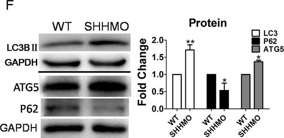 Western Blot: ATG5 Antibody - BSA Free [NB110-53818] - Autophagy level was promoted by downregulation of the Hh signaling pathway in zebrafish larvae. (A–C) Larvae were exposed to 10 µM cyA & 0.1% DMSO at 3 dpf for 3 days. (D–H) Embryos were injected with SHHMO, Gli2MO & Gli2Mis at the 1–4 cell stage; at 6 dpf, larvae were collected for assays . GAPDH served as a loading control. The means & s.d. were derived from triple duplicates. *P<0.05, **P<0.01, ***P<0.001 versus the WT groups or DMSO control groups (one-way ANOVA). The data were from three independent experiments. (A,D) SHH protein was detected by western blot assay. (B,E,G) Transcriptional level of autophagy-related genes was tested by qPCR assays. (C,F,H) Autophagy-related proteins LC3B II, ATG5 & P62 level were determined by western blot. Image collected & cropped by CiteAb from the following publication (//pubmed.ncbi.nlm.nih.gov/30992325), licensed under a CC-BY license. Not internally tested by Novus Biologicals.