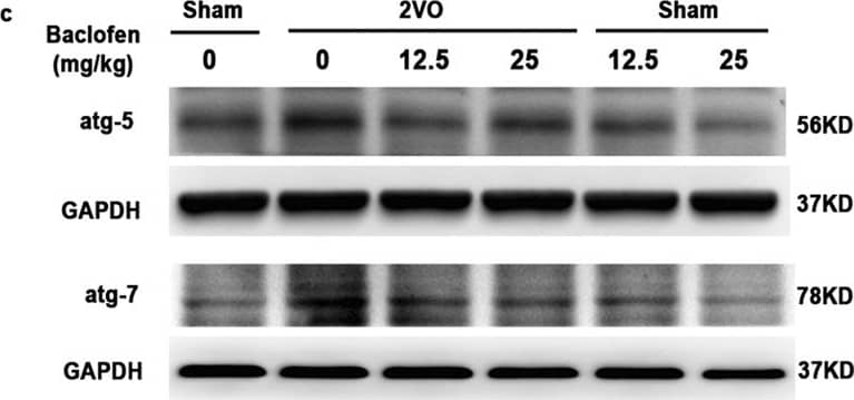 Western Blot: ATG5 Antibody - BSA Free [NB110-53818] - Baclofen reversed the changes of protein markers characteristic for autophagy in hippocampal CA1 area under chronic cerebral hypoperfusion.(a–c) Five weeks after induction of hypoperfusion, p-mTOR was significantly decreased, & LC3-II, Beclin 1, atg5 & atg7 were significantly increased, & baclofen could reverse the changes of these proteins expression. Treatment with baclofen at 12.5 mg/kg & 25 mg/kg in sham-operated rats did not change the expression of LC3-II, mTOR, p-mTOR, Beclin 1, atg5 & atg7 compared with sham-operated rats (n = 4 in each group). Blots shown have been cropped to fit space requirements & run under the same experimental conditions. *P < 0.05 & **P < 0.01 vs sham-operated rats; ##P < 0.01 vs 2VO rats. Image collected & cropped by CiteAb from the following publication (//www.nature.com/articles/srep14474), licensed under a CC-BY license. Not internally tested by Novus Biologicals.