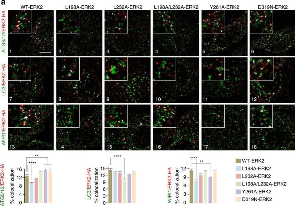 Immunocytochemistry/ Immunofluorescence: ATG5 Antibody - BSA Free [NB110-53818] - ERK2 utilizes kinase-docking domains to interact with ATG5–ATG12 & LC3-II.(a) Mutations in FRS on ERK2 decrease colocalization of ERK2 with ATG5–ATG12, LC3 & WIPI1. Immunofluorescence (IF) showing colocalization (depicted as white pixels by ‘colocalization finder application’) of WT-ERK2-HA, FRS ERK2 mutants (L198A-, L232A-, L198A/L232A-, Y261A-ERK2-HA) or common docking (CD) mutant (D319N-ERK2-HA) with ATG5–ATG12 (panels 1–6), LC3 (panels 7–12) or WIPI1 (panels 13–18) in EGF-treated NIH/3T3 cells. ERK2 is stained in red, & autophagy proteins are stained in green. Scale bar, 10 μm. The bars represent mean±s.e.m. **P<0.01, ****P<0.0001 compared with WT-ERK2-transfected cells; Student’s t-test, 50 cells analysed from n=2. (b) Mutations in FRS on ERK2 decrease colocalization of ERK2 with nuclear ATG5–ATG12 or LC3. IF showing colocalization (white pixels) of WT-ERK2-HA (red), FRS ERK2 mutants (L198A-, L232A-, L198A/L232A-, Y261A-ERK2-HA) or common docking (CD) mutant (D319N-ERK2-HA) with ATG5–ATG12 (panels 1–6) or LC3-II (panels 7–12) in EGF-treated NIH/3T3 cells. Scale bar, 5 μm. The bars represent mean±s.e.m. **P<0.01, ***P<0.001, ****P<0.0001 compared with WT-ERK2-transfected cells; Student’s t-test, 50 cells analysed from n=2. Arrows depict colocalization. (c) ATG5–ATG12 conjugation is required for ERK phosphorylation. Immunoblots for P-ERK, total ERK &  beta -actin in NIH/3T3 cells transfected with WT ATG5 or the conjugation-defective ATG5 K130R mutant & treated with EGF (10 min). The bars represent mean±s.e.m. *P<0.05 compared with WT ATG5-transfected cells; Student’s t-test, n=3. Image collected & cropped by CiteAb from the following publication (//www.nature.com/articles/ncomms3799), licensed under a CC-BY license. Not internally tested by Novus Biologicals.