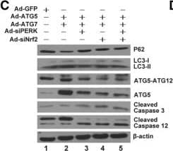 Western Blot: ATG5 Antibody - BSA Free [NB110-53818] - ATG5 & ATG7 influenced on autophagy, apoptosis & cell cycle through PERK/Nrf2 signaling. a The ER stress proteins were analysed by western blotting in Ad-GFP, Ad-ATG5 + Ad-ATG7,Ad-ATG5 + Ad-ATG7 + siPERK,Ad-ATG5 + Ad-ATG7 + siNrf2 & Ad-ATG5+ Ad-ATG7 + siPERK+siNrf2 induced chondrocytes. b The levels of ER stress proteins were normalized to  beta -actin. c Determination of autophagy & apoptosis proteins expression by western blotting in Ad-GFP, Ad-ATG5 + Ad-ATG7, Ad-ATG5 + Ad-ATG7 + siPERK,Ad-ATG5 + Ad-ATG7 + siNrf2 & Ad-ATG5+ Ad-ATG7 + siPERK+ siNrf2 induced chondrocytes. dThe levels of related proteins were normalized to  beta -actin. e FCM analysis was used to calculate the percentage of apoptotic cells at the time point of 24 h. The apoptosis rate were increased when combined treatment with silencing of PERK or Nrf2. Experiments were repeated 3 times, Representative images are shown. f Analysis of cell apoptosis. Data come from 3 independent experiments. g FCM analysis indicated that the S phase percentage were decreased compared to that of the control groups when combine infected with silencing of PERK or Nrf2 in C28I2 cells. Experiments were repeated 3 times, Representative images are shown. h Percentage of cells at each phase in different groups. *P < 0.05, **P < 0.01 compared with the controls. Values are means ± SD n = 3). (1:Ad-GFP, 2:Ad-ATG5 + Ad-ATG7, 3:Ad-ATG5 + Ad-ATG7 + siPERK, 4:Ad-ATG5 + Ad-ATG7 + siNrf2, 5:Ad-ATG5 + Ad-ATG7 + siPERK+ siNrf2) Image collected & cropped by CiteAb from the following publication (//pubmed.ncbi.nlm.nih.gov/31060556), licensed under a CC-BY license. Not internally tested by Novus Biologicals.