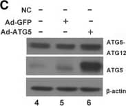 Western Blot: ATG5 Antibody - BSA Free [NB110-53818] - Expression of ER stress associated protein & autophagy related protein in the C28I2 chondrocyte infected with Ad-ATG5 or Ad-ATG7. a The ATG5 & ATG7 mRNA level were analysed by RT-PCR in C28I2 cells. b Analysis of ATG5 & ATG7 mRNA level with Q-PCR in C28I2 cells. Ad-ATG5(a), Ad-ATG7(b). c The ATG5 protein expression was analysed by western blotting in the Ad-ATG5 infected C28I2 cells. The level of ATG5 was normalized to  beta -actin. d The ATG7 protein expression was analysed by western blotting in the Ad-ATG7 infected C28I2 cells. The level of ATG7 was normalized to  beta -actin. e The expression levels of LC3, P62, PERK, p-PERK, Nrf2 proteins after infected with Ad-ATG5 in C28I2 cells for 24 h by western blotting. The levels of related proteins were normalized to  beta -actin. f The expression levels of LC3, P62, PERK, p-PERK, Nrf2 proteins after infected with Ad-ATG7 in C28I2 cells for 24 h by western blotting. The levels of related proteins were normalized to  beta -actin. *P < 0.05, **P < 0.01, ***P < 0.001 compared with the controls. Values are means±SD n = 3). (1:NC, 2: Ad-GFP, 3:Ad-ATG5(a) & Ad-ATG7(b), 4:NC, 5:Ad-GFP, 6:Ad-ATG5, 7:Ad-ATG7) Image collected & cropped by CiteAb from the following publication (//pubmed.ncbi.nlm.nih.gov/31060556), licensed under a CC-BY license. Not internally tested by Novus Biologicals.