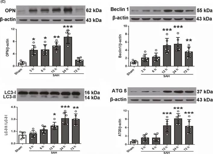 Western Blot ATG5 Antibody - BSA Free