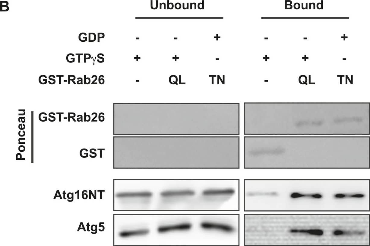 Western Blot: ATG5 Antibody - BSA Free [NB110-53818] - Atg16 is an effector of GTP-Rab26.(A) Co-Immunoprecipitation of FLAG-tagged Rab26 variants expressed in HeLa cells with endogenous Atg16L1 protein. Immunoprecipitation was carried out following lysis in detergent-containing buffer & clearance by centrifugation to remove cell debris. Note that only the GTP-preferring QL variant of Rab26 showed significant binding to Atg16L1 (arrow). (B) GST pulldown of purified recombinantly expressed GST-Rab26 variants with a pre-formed complex of His-tagged versions of Atg5 & the N-terminal domain of Atg16L1 (Atg16NT). Note that Atg16NT selectively interacted with the GTP-preferring QL-variant of Rab26.DOI://dx.doi.org/10.7554/eLife.05597.015Analyses of Rab26 & ATG16L1 interaction by analytical gel filtration.To analyze complexes formed between Atg16L1 & Rab26 or Rab33, samples containing either Rab protein were pre-incubated with Atg16NT/Atg5 & loaded on a Superdex 200 10/30 GL column. As controls, Rab26, Rab33, or Atg16NT/Atg5 alone were separately loaded & analyzed. Eluted fractions were collected, analyzed by SDS-PAGE & protein bands visualized using Coomassie staining. (A) The elution profiles for various samples analyzed. (B–F) Representative fractions were separated on SDS PAGE gels & stained with Coomassie to visualize the protein bands. (B) Co-migration of Rab26QL with Atg16NT/Atg5 was not detected when pre-incubated samples of these proteins were tested. (C) Complexes of Rab33QL with Atg16NT/Atg5 can be observed to co-migrated (fractions 5–7, arrows). (D–F) Control runs were performed using only Rab26QL, Rab33QL or Atg16NT/Atg5.DOI://dx.doi.org/10.7554/eLife.05597.016 Image collected & cropped by CiteAb from the following publication (//elifesciences.org/articles/05597), licensed under a CC-BY license. Not internally tested by Novus Biologicals.
