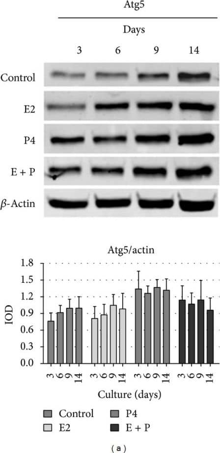 Western Blot: ATG5 Antibody - BSA Free [NB110-53818] - Expression of autophagic proteins (Atg5, Atg3, LC3, & beclin-1) & phosphorylated Bcl-2 (Ser70) in BME-UV1 cells forming acinar structures on Matrigel. Representative images of Western blot analysis of Atg5 (a), Atg3 (b), LC3 (c), beclin-1 (d), & phosphorylated Bcl-2 (Ser70) (f) in bovine MECs grown in 3D culture for 3, 6, 9, & 14 days in differentiation medium (control), enriched with 17 beta -estradiol (E2, 1 nM), progesterone (P4, 5 ng/mL), or both (E + P); expression of  beta -actin was used as a loading control; graphs below the images show the results of densitometric analysis, in which IOD of each band was measured, & the values were normalized to IOD of  beta -actin; the IOD results are presented as means ± SEM from at least three separate experiments. (e) Confocal images of immunofluorescence staining of beclin-1 (green fluorescence) in cells grown in 3D culture for 3 or 9 days in control conditions: DNA was counterstained with 7AAD (red fluorescence) & white arrows indicate the nuclear localization of beclin-1. Image collected & cropped by CiteAb from the following publication (//pubmed.ncbi.nlm.nih.gov/24895572), licensed under a CC-BY license. Not internally tested by Novus Biologicals.