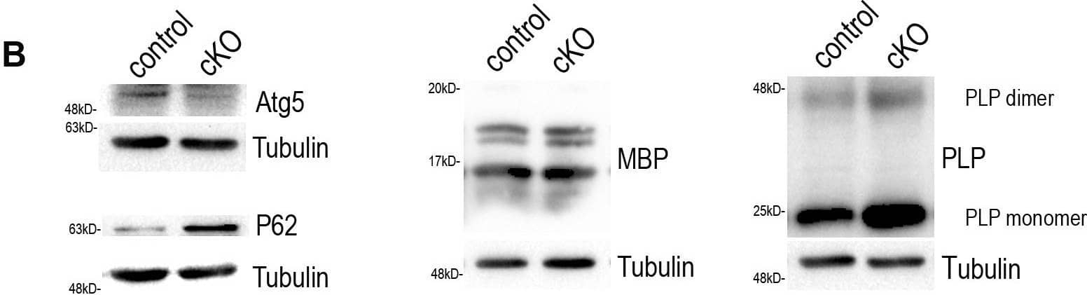 Western Blot: ATG5 Antibody - BSA Free [NB110-53818] - FIGURE 2: Blockage of autophagy leads to increased plp mRNA & protein levels.(A) Schematic illustration of the experimental protocol used for tamoxifen (TMX) induction & analysis in the plpCreERT2; atg5f/f mice. All animals were injected i.p. with 1 mg of TMX per day at the age of 2.5 months for 10 days with two days break in between. The analysis was performed at 6 mo. (B) Western blot analysis with antibodies against Atg5, P62, PLP & MBP proteins in optic nerve lysates of 6mo control & cKO mice. Representative images of a single experiment are depicted. (C) Quantification of normalized protein levels of “B”. (D) Quantification of quantitative real-time PCR in mouse optic nerves of 6mo control & cKO mice. Data information: Data are shown as mean ± SEM. N=3-4 animals per genotype. Student's t-test was used to determine statistical significance between control & cKO protein & mRNA levels. *p < 0.05, **p ≤ 0.01. Image collected & cropped by CiteAb from the following publication (//www.cell-stress.com/researcharticles/2022a-ktena-cell-stress/), licensed under a CC-BY license. Not internally tested by Novus Biologicals.
