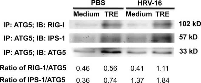 Western Blot: ATG5 Antibody - BSA Free [NB110-53818] - Autophagy-related gene 5 (ATG5) protein interacts with retinoic acid-inducible gene I (RIG-I) & IFN-beta  promoter stimulator 1 (IPS-1) in normal human primary airway epithelial cells.Normal human tracheobronchial epithelial cells were treated with medium or trehalose (TRE, 100 mM) for 48 h & then infected with HRV-16 (104 TCID50/well) for 2 h. After removing the free viruses, cells were incubated with medium or trehalose for additional 6 h. Pre-cleared cell lysates were incubated with a mouse anti-human ATG5 antibody, & immunoprecipitated proteins were separated on 10% SDS—PAGE for immunoblotting of RIG-I, IPS-1 & ATG5. The representative Western blot picture was shown from 2 independent experiments with each being performed in triplicate wells. Image collected & cropped by CiteAb from the following publication (//dx.plos.org/10.1371/journal.pone.0124524), licensed under a CC-BY license. Not internally tested by Novus Biologicals.