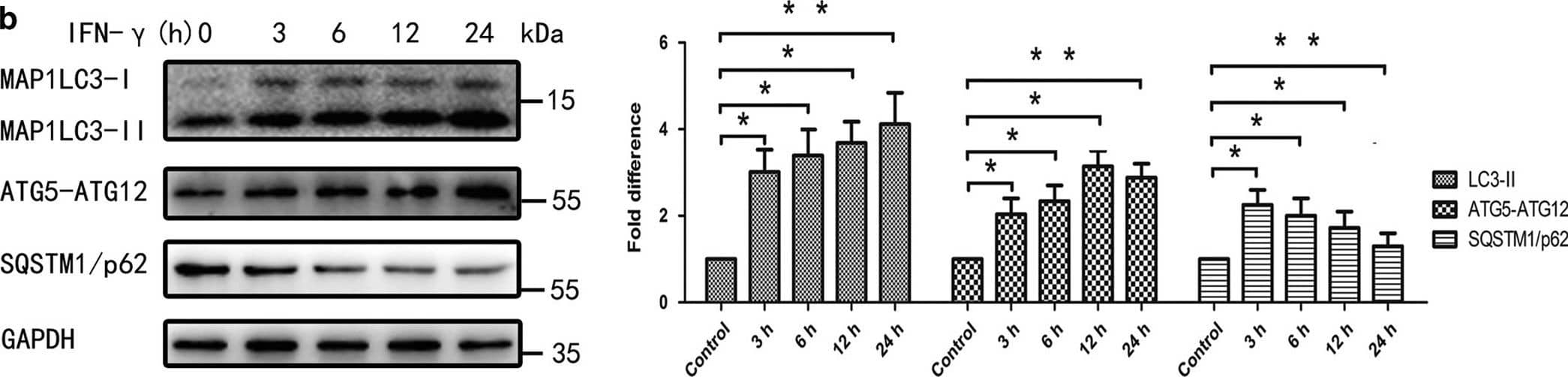 Western Blot: ATG5 Antibody - BSA Free [NB110-53818] - IFN-gamma  increased rates of autophagy in primary BMECs in vitro. (a) The expression of IFNGRs in BMECs. BMECs treated w/ IFN-gamma  for 6, 24 or 48 h. At the end of the treatment period, the levels of IFNGR1 & IFNGR2 analysed using western blot analysis w/ specific antibodies as described in the Materials & Methods section. The data represent the mean±S.E.M. of three independent experiments. Error bars are ±S.E.M. One-way ANOVA; *P<0.05; **P<0.01. (b) BMECs treated w/ IFN-gamma  for 3, 6, 12 or 24 h. At the end of the treatment, levels of MAP1LC3, ATG12-ATG5, SQSTM1/p62 & GAPDH analysed using western blot analysis w/ specific antibodies as described in the Materials & Methods section. The data represent the mean±S.E.M. of three independent experiments. Error bars are ±S.E.M. One-way ANOVA; *P<0.05; **P<0.01. (c) BMECs treated w/ IFN-gamma  at 2.5, 5, 10 or 20 ng/ml. At the end of the treatment, levels of MAP1LC3, ATG12-ATG5, SQSTM1/p62 & GAPDH analysed using western blot analysis w/ specific antibodies as described in the Materials & Methods section. The data represent the mean±S.E.M. of three independent experiments. Error bars are ±S.E.M. One-way ANOVA; *P<0.05; **P<0.01. (d) Direct effect of IFN-gamma  on induction of autophagy. BMECs cultured for 24 h in supernatants from either mock-treated BMECs or cells treated w/ 10 ng/ml of IFN-gamma  for 24 h in the presence or absence of anti-IFNGR1, IFNGR2 or IFNGR1/2. At the end of the treatment, levels of MAP1LC3, ATG12-ATG5, SQSTM1/p62 & GAPDH analysed using western blot analysis w/ specific antibodies as described in the Materials & Methods section. The data represent the mean±S.E.M. of three independent experiments. Error bars are ±S.E.M. One-way ANOVA; *P<0.05; **P<0.01. Image collected & cropped by CiteAb from the following publication (//www.nature.com/articles/cddiscovery201565), licensed under a CC-BY license. Not internally tested by Novus Biologicals.