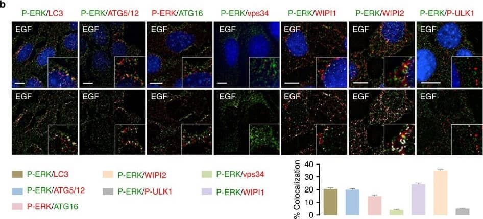 Immunocytochemistry/ Immunofluorescence: ATG5 Antibody - BSA Free [NB110-53818] - Components of the ERK signalling cascade associate with APh.(a) EGF enhances colocalization of phosphorylated (P)-bRAF, P-MEK & P-ERK with LC3. Immunofluorescence (IF) showing colocalization of P-bRAF (green), P-MEK (green) & P-ERK (green) with LC3 (red) in NIH/3T3 cells in presence or absence of EGF (10 min as shown in scheme). The bars represent mean±s.e.m. **P<0.01, ***P<0.001; Student’s t-test, 60 cells analysed from two experiments. Scale bars, 10 μm. (b) P-ERK colocalizes with pre-autophagosomal & autophagosomal structures. IF depicting colocalization of P-ERK (green or red) with LC3 (red), ATG5–ATG12 (red), ATG16 (green), vps34 (red), WIPI1 (red), WIPI2 (red) & P-ULK1 (red) in EGF-treated NIH/3T3 cells. Scale bars, 10 μm. The bars represent mean±s.e.m. 50 cells analysed from two experiments. (c) Growth factors in serum maintain P-ERK/LC3 colocalization. IF depicting colocalization of P-ERK (green) with LC3 (red) in 2 h serum-fed NIH/3T3 cells. (a–c) Native merged images or images with colocalization highlighted in white pixels are shown. Nuclei are blue (DAPI). Scale bar, 10 μm. Image collected & cropped by CiteAb from the following publication (//www.nature.com/articles/ncomms3799), licensed under a CC-BY license. Not internally tested by Novus Biologicals.