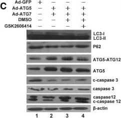 Western Blot: ATG5 Antibody - BSA Free [NB110-53818] - The effect of ATG5 & ATG7 on autophagy, ER stress, apoptosis & cell cycle depends on PERK. a The ER stress proteins were analysed by western blotting in the GSK2606414 treated chondrocytes. b The levels of ER stress proteins were normalized to  beta -actin. c Determination of autophagy & apoptosis proteins expression by western blotting in the GSK2606414 treated chondrocytes. d The levels of related proteins were normalized to  beta -actin. e FCM analysis was used to calculate the percentage of apoptotic cells at the time point of 24 h. The apoptosis rate were increased when combined treated with GSK2606414. Experiments were repeated 3 times, Representative images are shown. f Analysis of cell apoptosis. Data come from 3 independent experiments. g FCM analysis indicated that the S phase percentage were decreased compared to that of the control groups when combine treated with GSK2606414 in C28I2 cells. Experiments were repeated 3 times, Representative images are shown. h Percentage of cells at each phase in different groups. *P < 0.05, **P < 0.01 compared with the controls. Values are means ± SD n = 3). (1:Ad-GFP, 2:Ad-ATG5 + Ad-ATG7, 3:Ad-ATG5 + Ad-ATG7 + DMSO, 4:Ad-ATG5 + Ad-ATG7+ GSK2606414) Image collected & cropped by CiteAb from the following publication (//pubmed.ncbi.nlm.nih.gov/31060556), licensed under a CC-BY license. Not internally tested by Novus Biologicals.