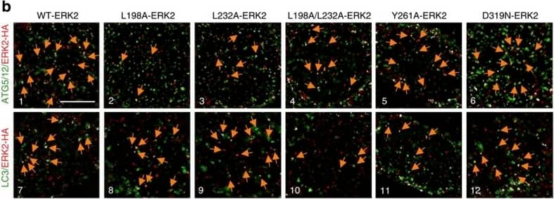 Immunocytochemistry/ Immunofluorescence: ATG5 Antibody - BSA Free [NB110-53818] - ERK2 utilizes kinase-docking domains to interact with ATG5–ATG12 & LC3-II.(a) Mutations in FRS on ERK2 decrease colocalization of ERK2 with ATG5–ATG12, LC3 & WIPI1. Immunofluorescence (IF) showing colocalization (depicted as white pixels by ‘colocalization finder application’) of WT-ERK2-HA, FRS ERK2 mutants (L198A-, L232A-, L198A/L232A-, Y261A-ERK2-HA) or common docking (CD) mutant (D319N-ERK2-HA) with ATG5–ATG12 (panels 1–6), LC3 (panels 7–12) or WIPI1 (panels 13–18) in EGF-treated NIH/3T3 cells. ERK2 is stained in red, & autophagy proteins are stained in green. Scale bar, 10 μm. The bars represent mean±s.e.m. **P<0.01, ****P<0.0001 compared with WT-ERK2-transfected cells; Student’s t-test, 50 cells analysed from n=2. (b) Mutations in FRS on ERK2 decrease colocalization of ERK2 with nuclear ATG5–ATG12 or LC3. IF showing colocalization (white pixels) of WT-ERK2-HA (red), FRS ERK2 mutants (L198A-, L232A-, L198A/L232A-, Y261A-ERK2-HA) or common docking (CD) mutant (D319N-ERK2-HA) with ATG5–ATG12 (panels 1–6) or LC3-II (panels 7–12) in EGF-treated NIH/3T3 cells. Scale bar, 5 μm. The bars represent mean±s.e.m. **P<0.01, ***P<0.001, ****P<0.0001 compared with WT-ERK2-transfected cells; Student’s t-test, 50 cells analysed from n=2. Arrows depict colocalization. (c) ATG5–ATG12 conjugation is required for ERK phosphorylation. Immunoblots for P-ERK, total ERK &  beta -actin in NIH/3T3 cells transfected with WT ATG5 or the conjugation-defective ATG5 K130R mutant & treated with EGF (10 min). The bars represent mean±s.e.m. *P<0.05 compared with WT ATG5-transfected cells; Student’s t-test, n=3. Image collected & cropped by CiteAb from the following publication (//www.nature.com/articles/ncomms3799), licensed under a CC-BY license. Not internally tested by Novus Biologicals.